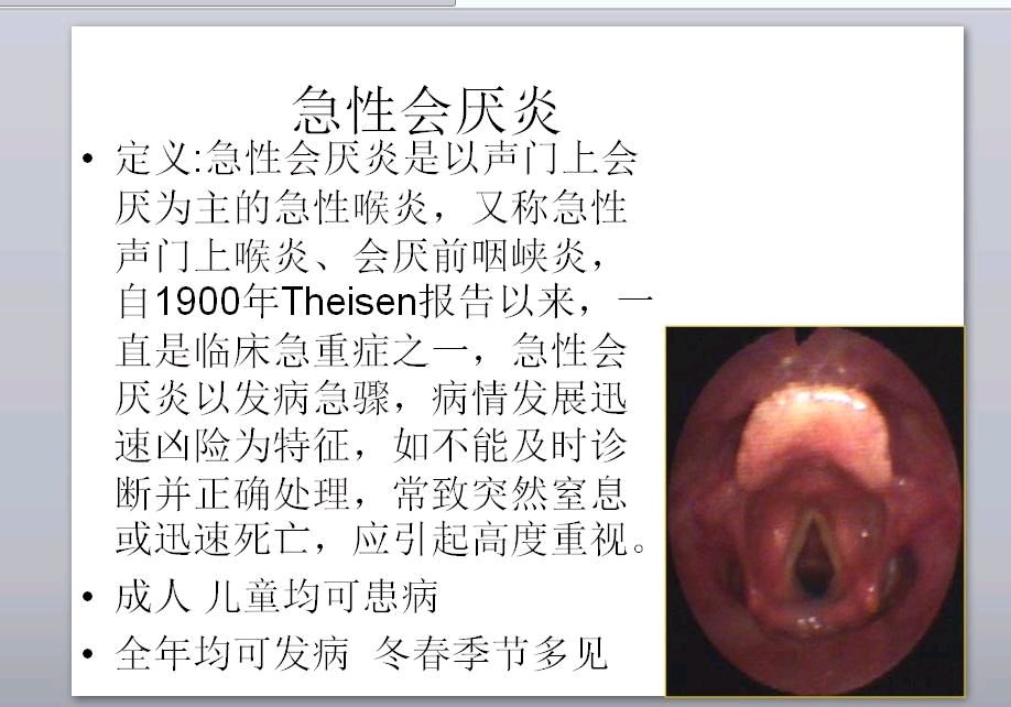 急性会厌炎-潜在的致命性疾病您重视了吗