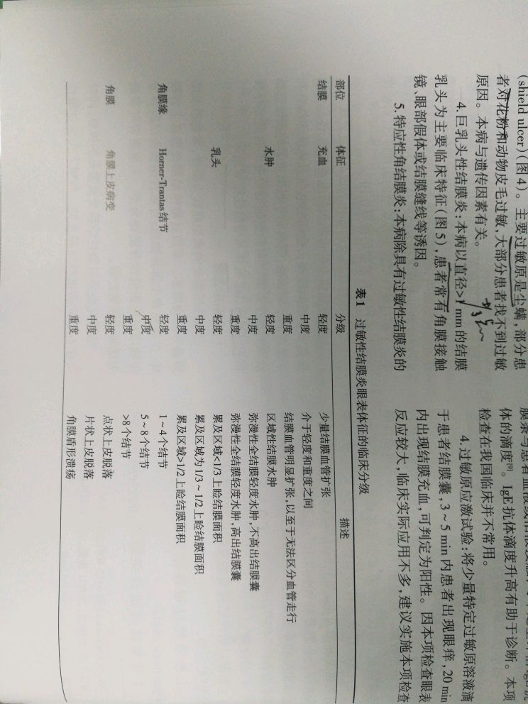 过敏性结膜炎药物治疗策略
